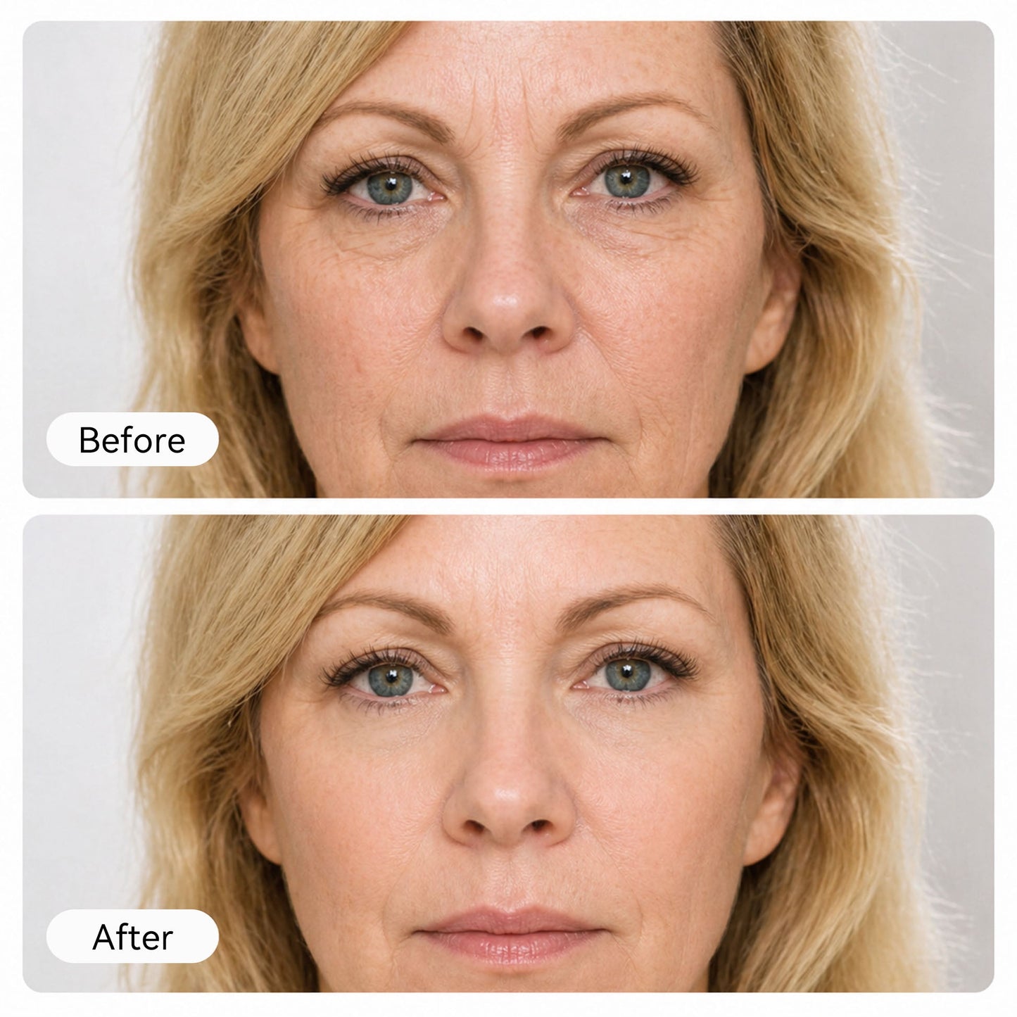 Anuarn NAD+ EGF Firming Serum