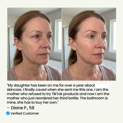 Anuarn Silk Collagen Ampoule