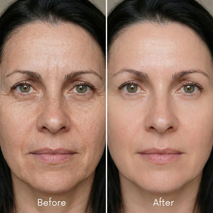 Anuarn Silk Collagen Ampoule